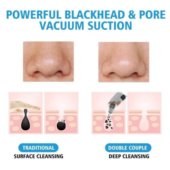 Portable Blackhead Pore Cleaner - Image 2